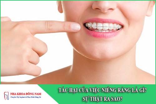 tác hại của việc niềng răng