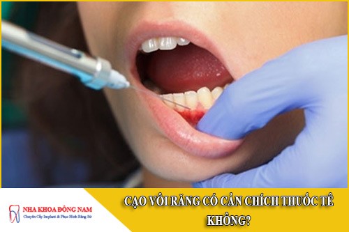 cạo vôi răng có cần chích thuốc tê không