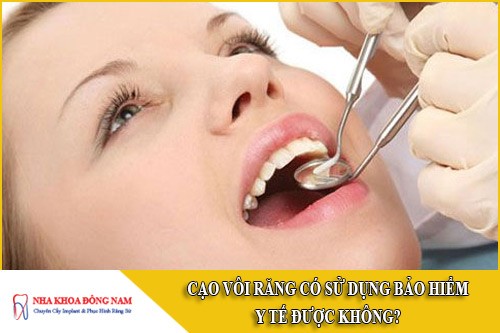 cạo vôi răng có được sử dụng bảo hiểm y tế không