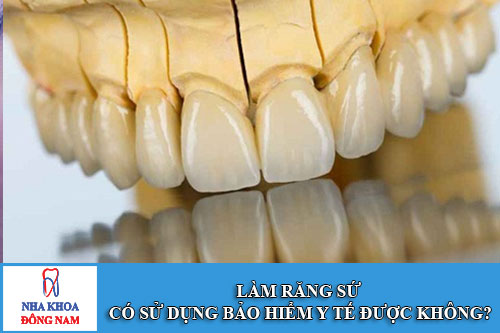 Làm răng sứ có sử dụng Bảo Hiểm Y Tế được không