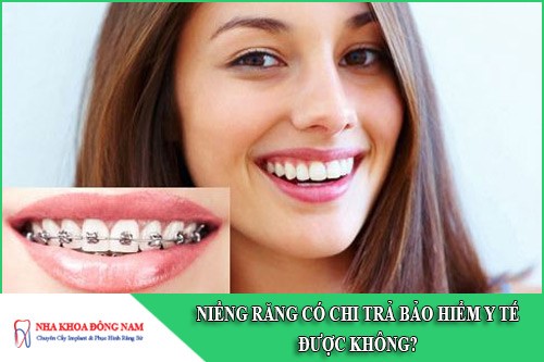 niềng răng có chi trả bảo hiểm y tế được không