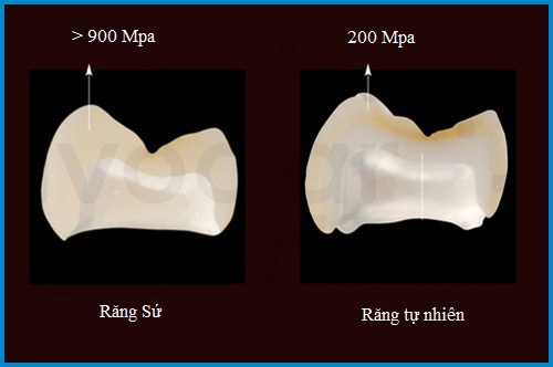 so sánh độ cứng của răng sứ với răng thật 4