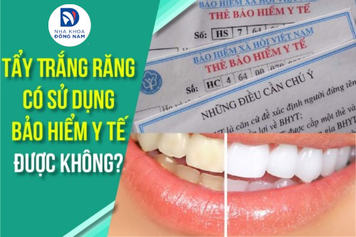 Tẩy Trắng Răng có sử dụng Bảo Hiểm Y Tế được không