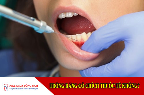 Trồng răng có chích thuốc tê không