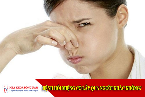 bệnh hôi miệng có lây qua người khác không