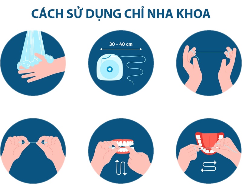 Cách dùng chỉ nha khoa đúng cách