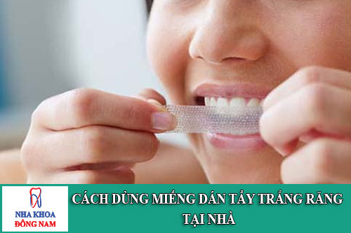 Cách dùng miếng dán tẩy trắng răng tại nhà