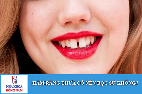 hàm răng thưa có nên bọc sứ không