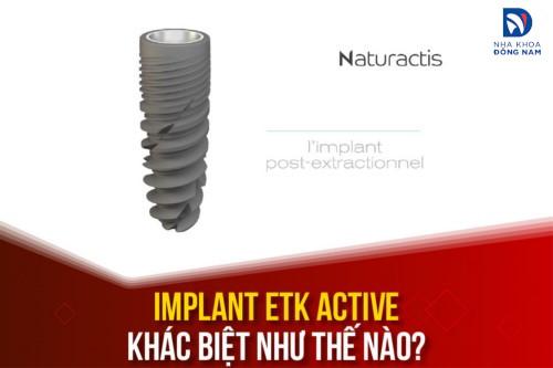Implant ETK Active Khác Biệt Như Thế Nào