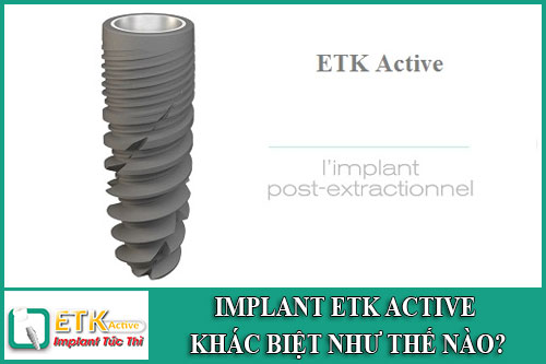 implant etk active khác biệt như thế nào