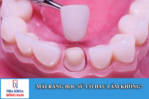 Mài răng bọc sứ có đau lắm không