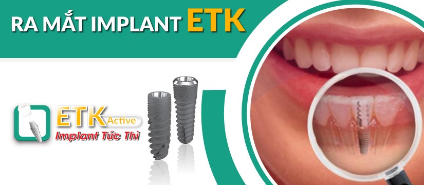 nha khoa đông nam ra mắt implant mới - etk active
