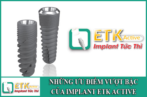 những ưu điểm vượt bậc của implant etk active