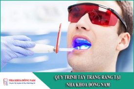 quy trình tẩy trắng răng tại nha khoa