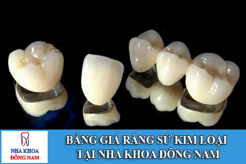 Bảng giá răng sứ kim loại tại Nha Khoa Đông Nam