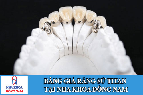 Bảng giá răng sứ Titan tại Nha Khoa Đông Nam
