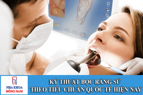 Kỹ thuật bọc răng sứ theo tiêu chuẩn quốc tế hiện nay