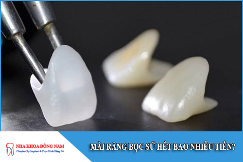 mài răng bọc sứ hết bao nhiêu tiền