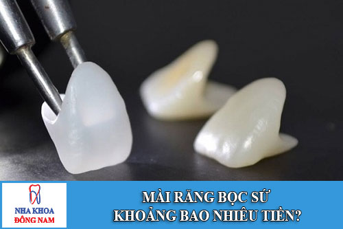 Mài răng bọc sứ khoảng bao nhiêu tiền
