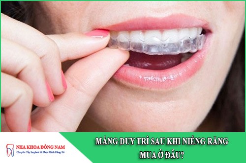 máng duy trì sau khi niềng răng mua ở đâu