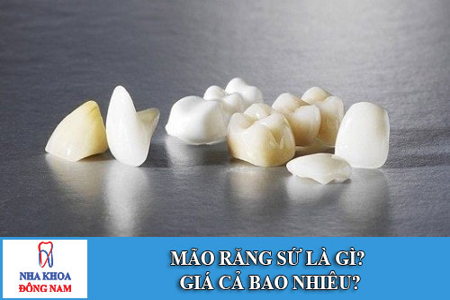 mão răng sứ là gì? giá cả bao nhiêu?