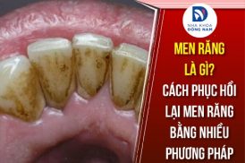 men răng là gì cách phục hồi lại men răng bằng nhiều phương pháp