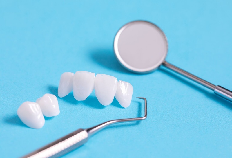 Răng sứ Emax là dòng răng toàn sứ cao cấp