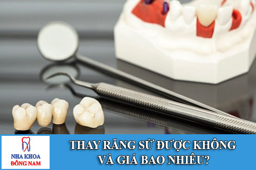 Thay răng sứ được không và giá bao nhiêu