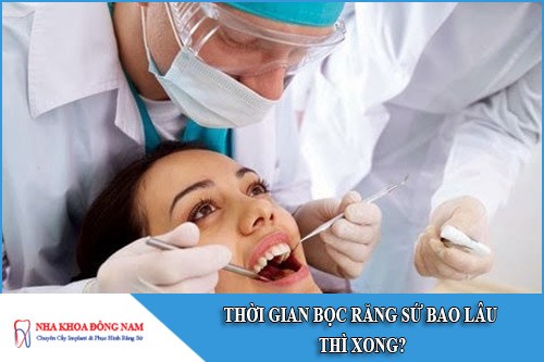 thời gian bọc răng sứ bao lâu thì xong