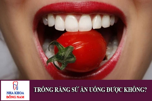 Trồng răng sứ ăn uống được không