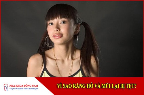 vì sao răng hô và mũi lại bị tẹt