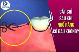 Cắt Chỉ Sau Khi Nhổ Răng Có Đau Không?