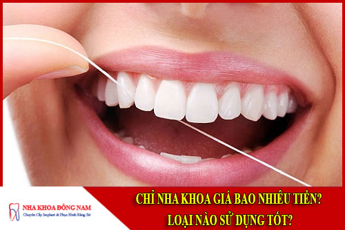 chỉ nha khoa, giá chỉ nha khoa