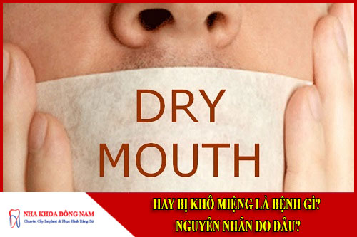 Hay bị khô miệng là bệnh gì
