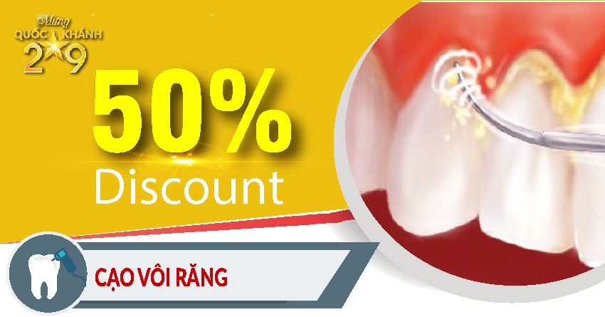 Khuyến mãi nha khoa mừng quốc khánh 2-9 - Cạo vôi răng
