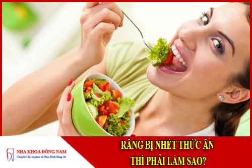 Răng bị nhét thức ăn thì phải làm sao