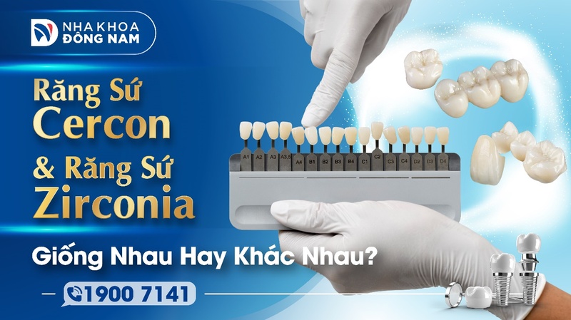 Răng Sứ Cercon Và Răng Sứ Zirconia Giống Nhau Hay Khác Nhau?