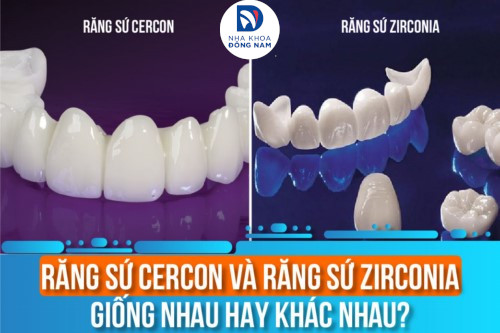 Răng Sứ Cercon Và Răng Sứ Zirconia Giống Nhau Hay Khác Nhau?