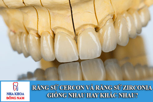 Răng sứ cercon và răng sứ zirconia giống nhau hay khác nhau