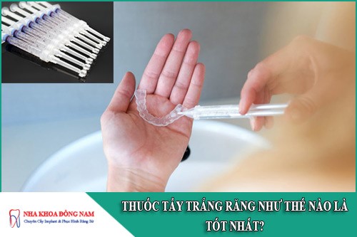 thuốc tẩy trắng răng như thế nào là tốt nhất