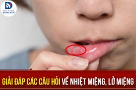 Giải Đáp Các Câu Hỏi Về Nhiệt Miệng, Lở Miệng