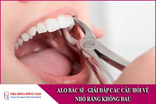 giải đáp các câu hỏi về nhổ răng không đau