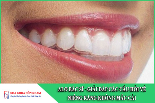 giải đáp các câu hỏi về niềng răng không mắc cài
