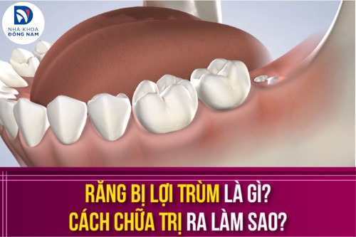 Những chiếc răng nào đã mọc và chúng được điều trị như thế nào