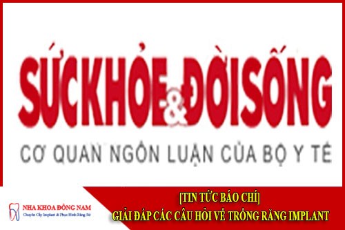 Giải đáp câu hỏi về trồng răng implant