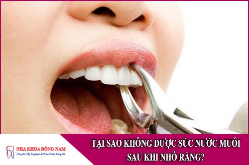 tại sao không được súc nước muối sau khi nhổ răng