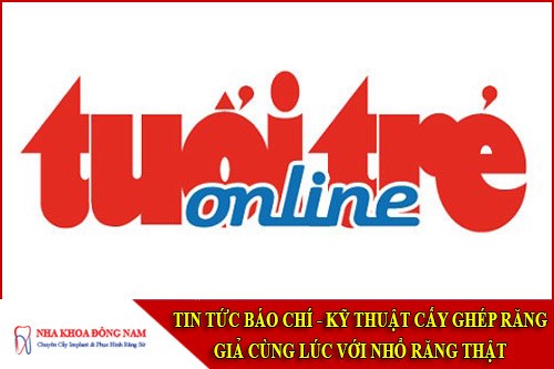 kỹ thuật cấy ghép răng giả cùng lúc với nhổ răng thật