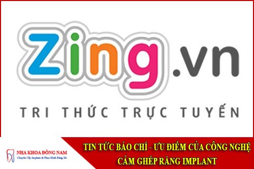 ưu điểm của công nghệ căm ghép răng implant