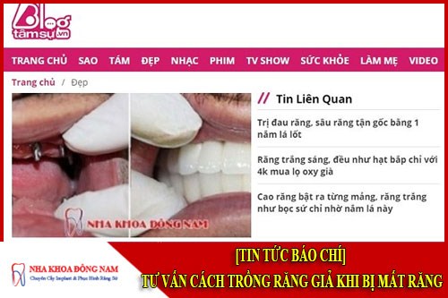 Tư vấn cách trồng răng giả khi bị mất răng