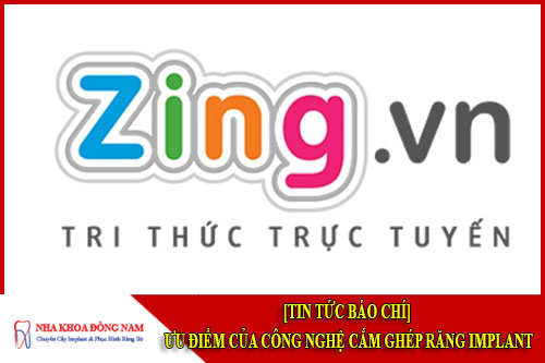 Ưu điểm của công nghệ cấy ghép Implant